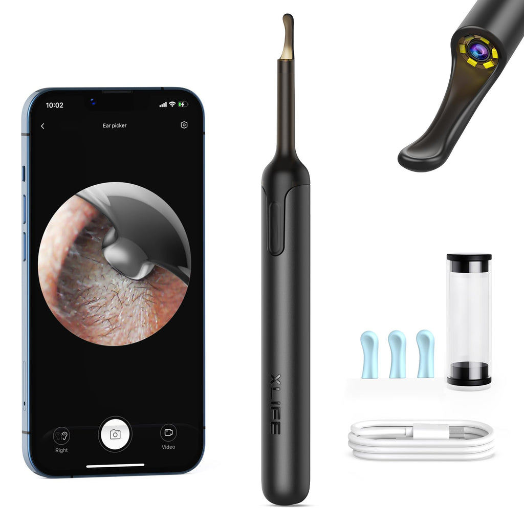 Ear Wax Removal,Bebird Ear Camera,Ear Wax Removal Tool,Earwax Removal Kit with 6LED Light,Ear Cleaner with Camera and Light Built-in WiFi with Soft Silicone Ear Scoops,Ear Wax Camera for iOS & Android Carbon Black