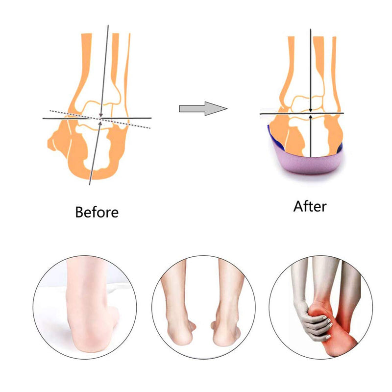 [Australia] - PCSsole 3/4 Orthopedic Insoles for Flat Feet, Plantar Fasciitis, Heel Spurs, Half Shoe Insoles with High Arch, Shoe Insoles Relieve Heel Pain for Women & Men EU43-46 Blue 