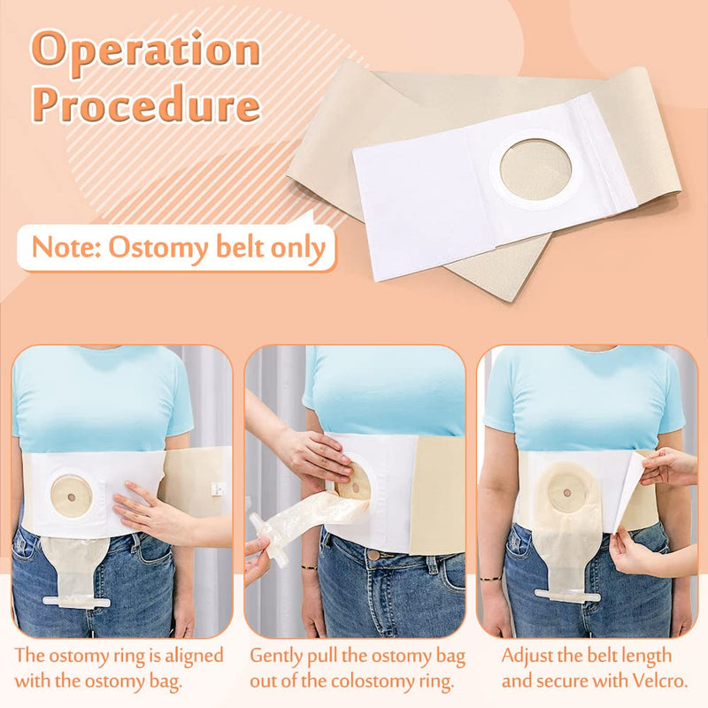 [Australia] - Mybow Ostomy Belt Hernia for Men Women, Urostomy Belt Ostomy Wrap, Stoma Protector, Ileostomy Support Belt, Colostomy Post Operative Abdominal Binder, Hernia Wrap Belt (XL 40-43) X-Large (Pack of 1) 