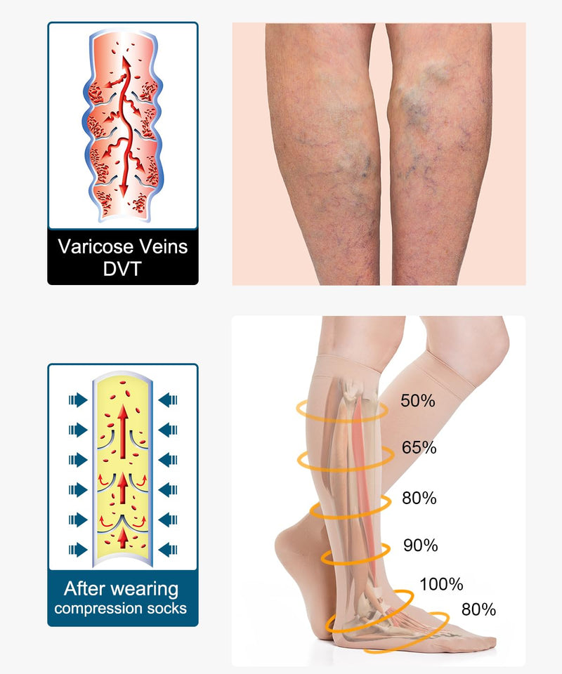[Australia] - Medical Compression Stockings Women & Men 20-30 mmHg Class 2, Size S-4XL, Graduated Support Compression Socks Support Stockings for Varicose Veins Edema Flight XL Beige 