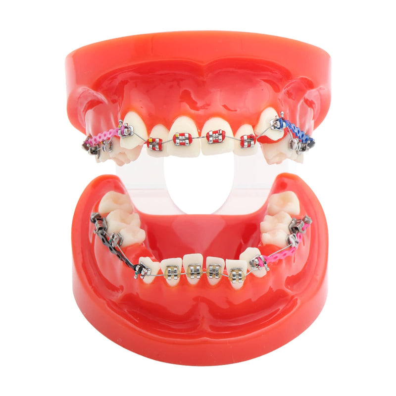[Australia] - Orthodontic O-rings, orthodontic ligature ties, orthodontic ligature ties, orthodontic ligature ring, orthodontic ligature ties, transparent, 40 pieces 