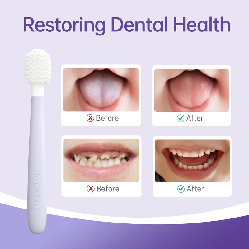 [Australia] - Kids Tongue Scraper, Tongue Cleaner for Infant & Newborn, Baby Oral Cleaner Newborn, Toddler Toothbrush for Tooth Mouth Gum Clean, Infant Toothbrush Oral Cleaning Stick… Air 