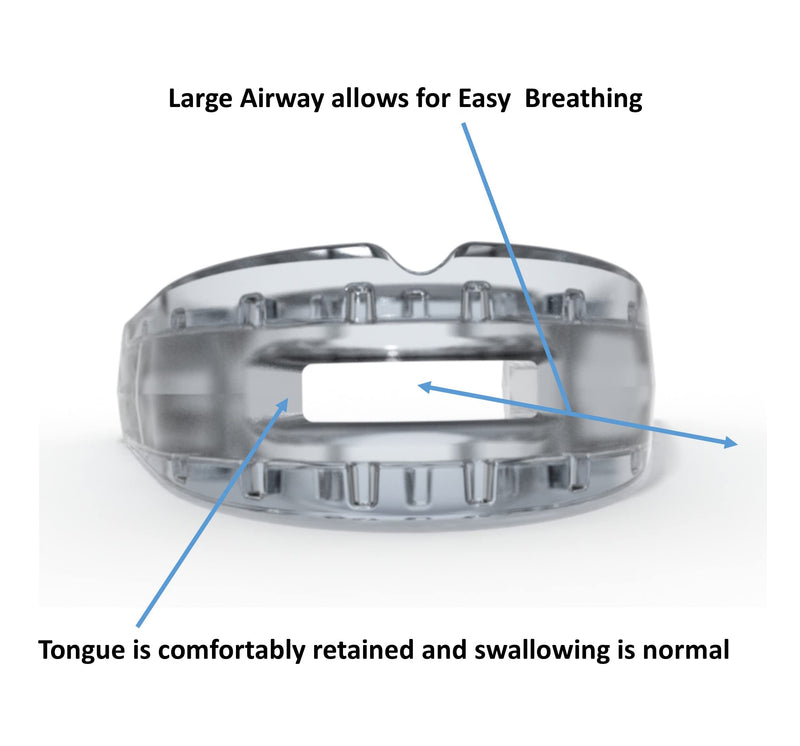 [Australia] - Dentemp SleepTight Mouthpiece – Anti Snoring Device - Custom Fit Snoring Mouthguard for a Sleep Apnea - Device Designed by Dentist and Made in USA 1pk 