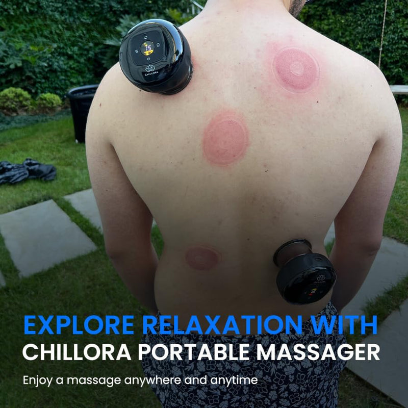 [Australia] - Smart Cupping Therapy Massager 4-in-1 Set | Red Light Therapy for Targeted Muscle, Aches, Knots | Celulite Massager Kit with 12 Levels Temperature & 20 Level Suction | Circulation 