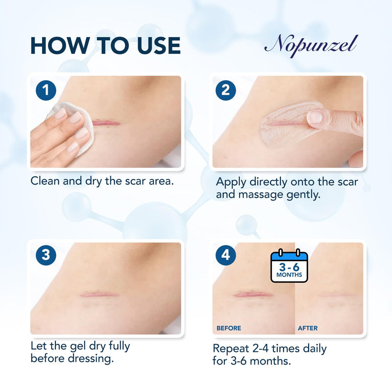 Silicone Scar Gel: Silicone Gel for Scars - Improve Scar Appearance for Old and New Scars - Medical Grade Silicone - Advanced Scar Gel - Scalds - Surgery - Injury - C Section - Stitches - Burns - 20g