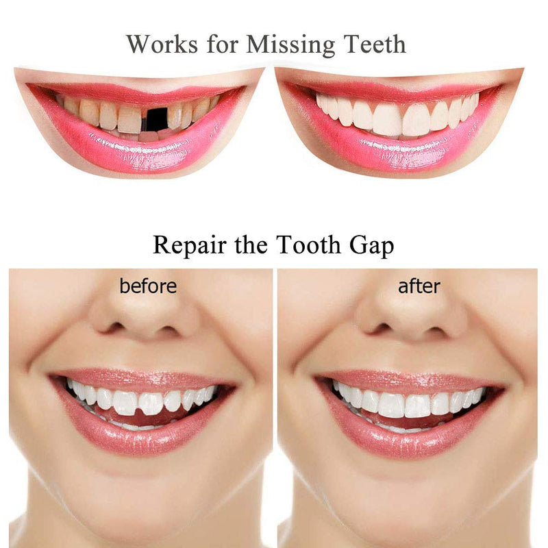 [Australia] - Tooth Repair Kit-Thermal Beads for Filling Fix The Missing and Broken Tooth or Adhesive The Denture Fake Teeth 