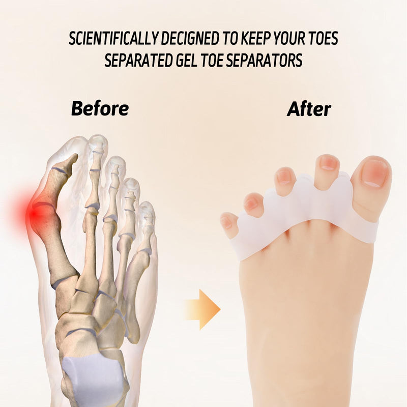 [Australia] - Giantree Pack of 4 Silicone Toe Separators for All Toes, Foot Toe Separators for Bunion Correction Toes Overlapping Toes Relieved Foot Pain White 