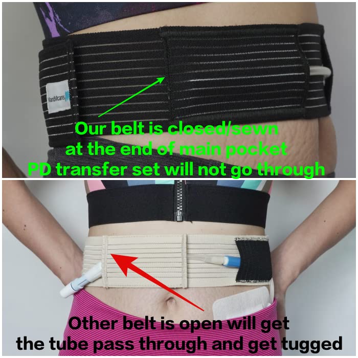 [Australia] - Peritoneal Dialysis Breathable PD Catheter Belt | Secure Peg Tube Feeding Holder | Supplies for PD Dialysis Men and Women Small Black 