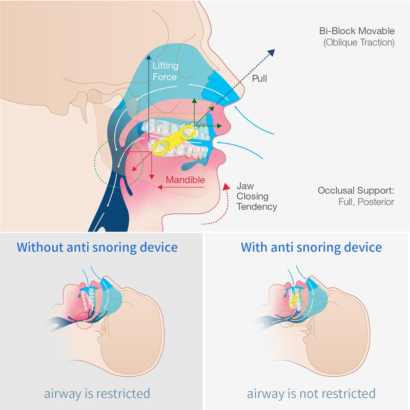 20PCS Replacement Elastic Straps for Meyson EMA Application (Blue, 16 mm) 16mm Blue