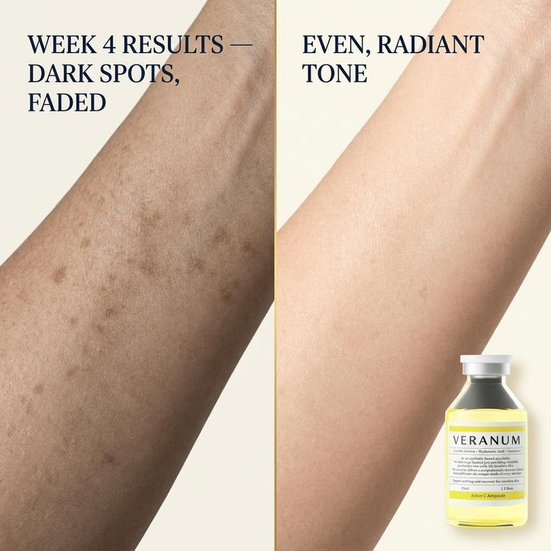 Active C Ampoule – 25% Stabilized Vitamin C Brightening & Firming Serum with Triple Collagen, Centella EV & Peptides – Non-Irritating Korean Skincare for Radiant, Even-Tone Skin – 1.2 fl oz