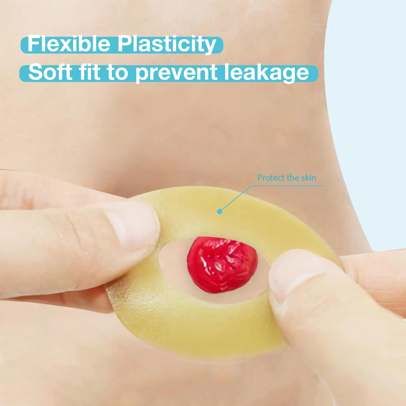 [Australia] - 20PCS Moldable Ostomy Barrier Rings, Elastic Skin Extender Rings, 2mm Thickness Medical Hydrocolloid Ostomy Bag Supplies, Better Seal No Leaking Skin Barrier Ring for Colostomy Bags 20 PCS 