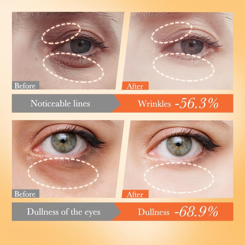 Vitamin C Repair Eye Cream for Dark Circles, Wrinkles, Fine Lines and Bags Under Eyes, Reduce Dullness, Moisturizing the Eye Area