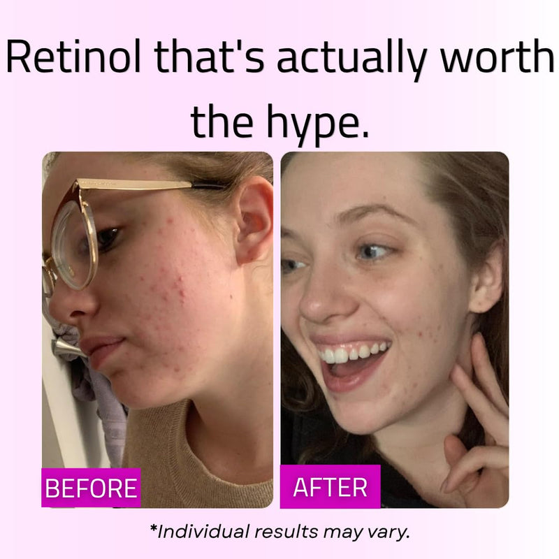GLEOW Retinol Serum for Face with Hyaluronic Acid and Vitamin E, Gentle Retinol Face Serum Targets the Appearance of Fine Lines and Wrinkles, 2oz Retinol Serum 2oz