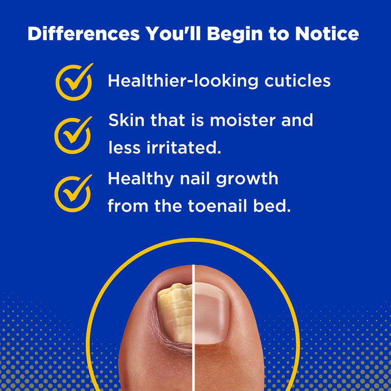 Baar Toelieva Undecylenic Acid Liquid, 25%, 2 oz | Contains 25% undecylenic acid with organic olive oil and grapefruit seed extract for application under and around toenails