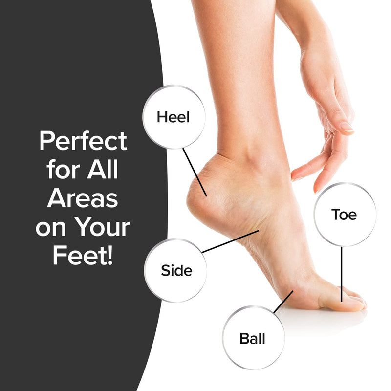 [Australia] - PedEgg Power Cordless Motorized Callus Remover w/ Bright LED Light As Seen On TV, Quickly Removes Calluses & Dry Skin w/ 2000 RPMs of Spinning Action for Smooth, Soft Feet, Easy-Grip Ergonomic Handle 