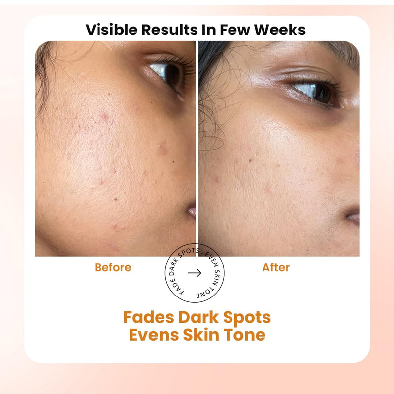 TRUTH & BEAUTY Vitamin C Serum for Face With Hyaluronic and Ferulic Acid, Boost Skin Collagen,Hydrate & Plump Skin, Anti Aging & Wrinkle Facial Serum - 1.01 Fl Oz Advance Advance C Radiance Serum