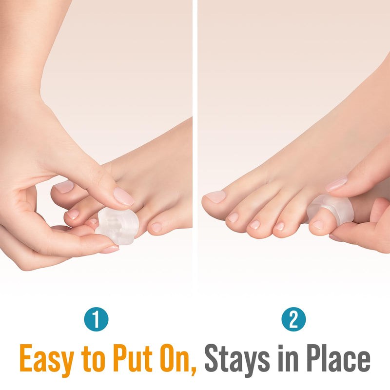 [Australia] - 5 STARS UNITED Pinky Toe Spacers for Men & Women ‚Äì 4 Gel Separators for Overlapping & Curled Little Toes, Bunions, Alignment - Diabetic Foot Care, Silicone Spreader, Corrector & Straightener, Clear Small 4 Pack 