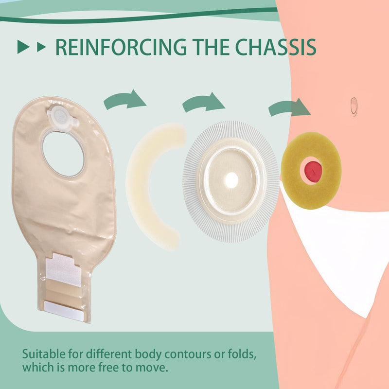 [Australia] - 30Pcs Ostomy Barrier Rings, 2mm Thickness Hydrocolloid Tape Cohesive Seals, Elastic Moldable Skin Extender, Ostomy Supplies for Colostomy, Ileostomy & Urostomy Bags 