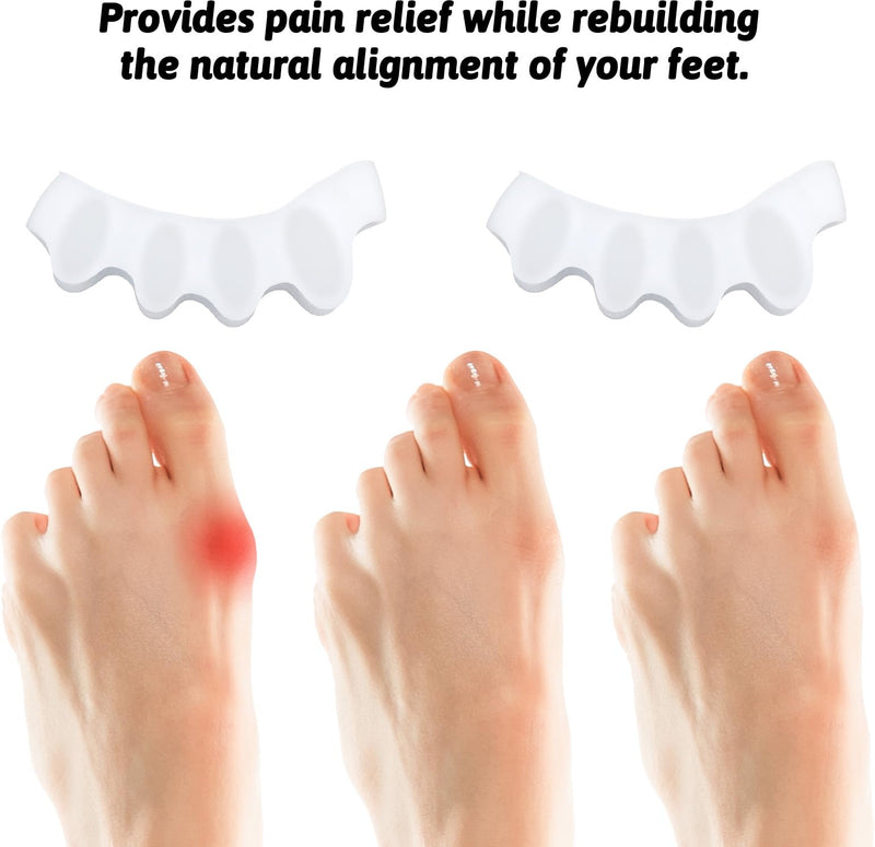 [Australia] - Giantree Pack of 4 Silicone Toe Separators for All Toes, Foot Toe Separators for Bunion Correction Toes Overlapping Toes Relieved Foot Pain White 