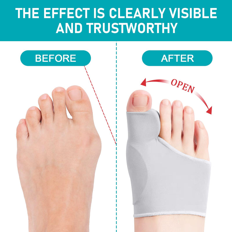 [Australia] - Hallux Valgus Socks, Hallux Valgus Correction, Big Toe Bandage Correction, Hallux Valgus Toe Separator Correction, Hallux Valgus Bandage with Silicone Pads for Men and Women (37-43 M, Grey) 