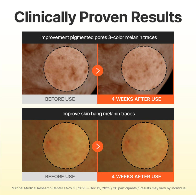 CENTELLIAN 24 Madeca Vitamin 15+ Glowing Serum - Uneven Skin Tone Care | Serum with 15% Multi-Vitamin Complex, Niacinamide, TECA and Ascorbic Acid for Uneven Tone and Radiance, 1.01 fl oz Glowing Serum 1.01 fl oz