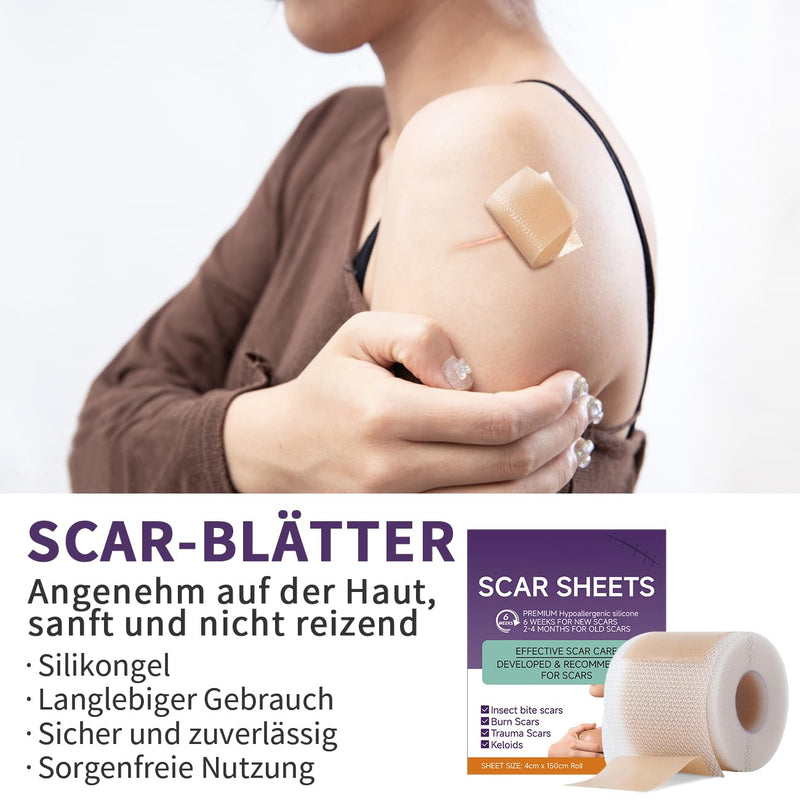 [Australia] - Scar plaster, silicone scar tape, silicone plaster for scars, silicone scar plaster, reusable silicone scar plaster, safe and effective (4 cm x 150 cm roll) Bluez1 