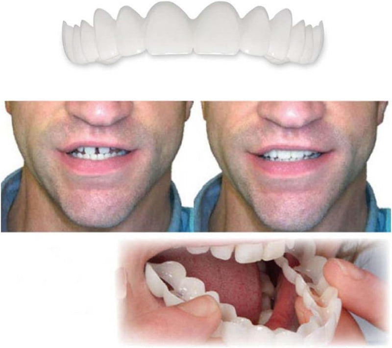 [Australia] - ‌2 Pairs Adjustable Temporary for Men & Women, Natural Comfortable Design to Restore Confident Smile (1) 1 