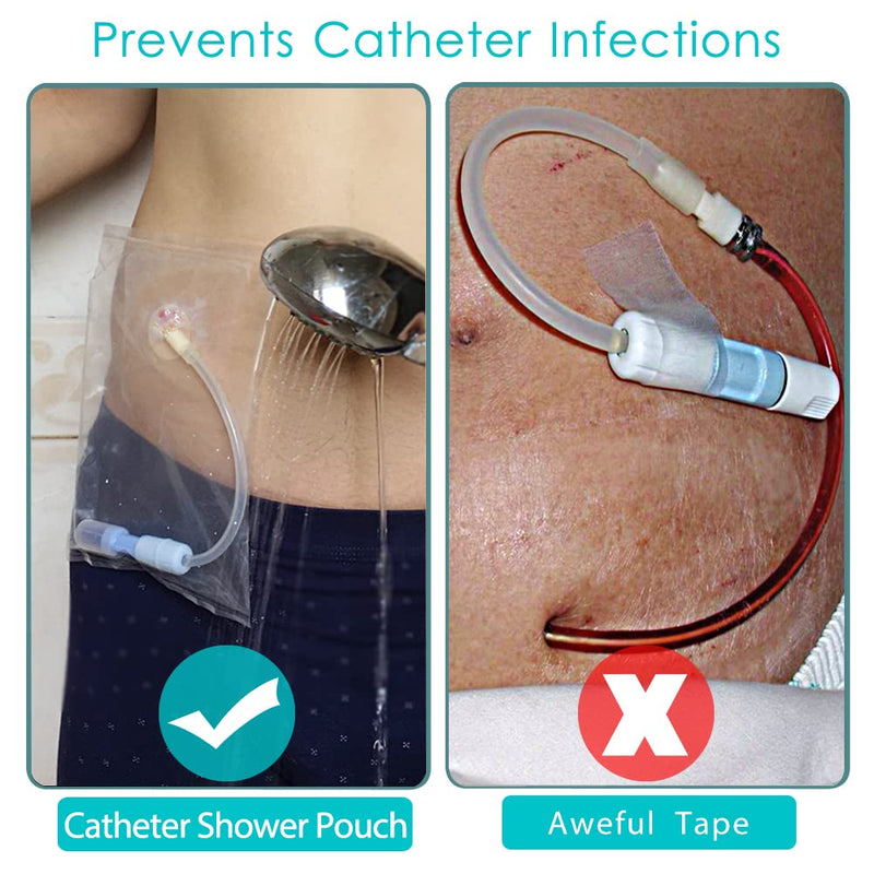 [Australia] - Waterproof Peritoneal Dialysis Shower Pouch PD Catheter Holder Gtube Covers Protector for Feeding Tube Supplies Peg Dialysis Belt Accessories Adults Women Men (Pack of 25) Pack of 25 Transparent 
