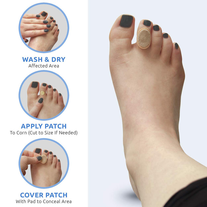 [Australia] - Comfort Zone Corn Removers Medicated Patches, Effective Corn Removal Pads with Salicylic Acid, 18 Medicated Patches and 18 Protective Pads 