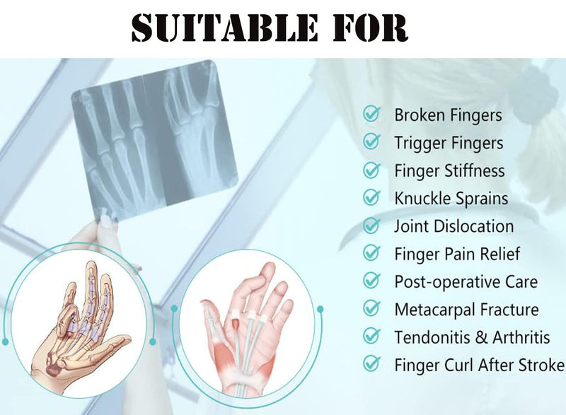 2 Finger Splint Brace Hand Wrist Support Universal for Left or Right Hand Two Trigger Finger Splint Adjustable Finger Straightening Immobilizer for Boxer Fractures, Arthritis, Mallet Finger, Sprains, Metacarpal Fractures, Broken Fingers Pain Relief