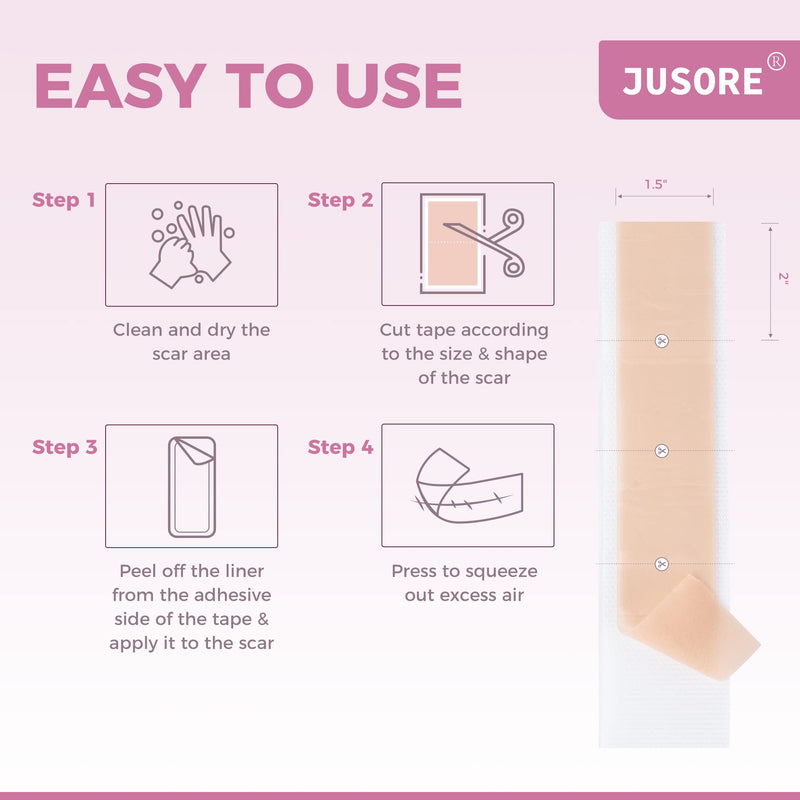 [Australia] - Silicone Scar Tape Scar Sheets - Professional Medical Grade Scar Removal Treatment, Non irritating, Painless for C-Section, Surgical Scars, Burn, Keloid, Acne(1.6” x 60” Roll) 4x150cm 