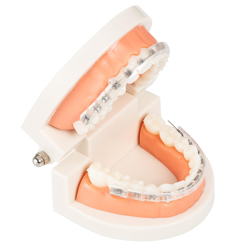 [Australia] - Comfort Cover for Braces - Lip Protector, Orthodontic Lip Cushion, Mouth Guard Clear Teeth Shield Bumper for Brackets, Aligner, Dental Wax Alternative, in Portable Storage Case with Mirror 