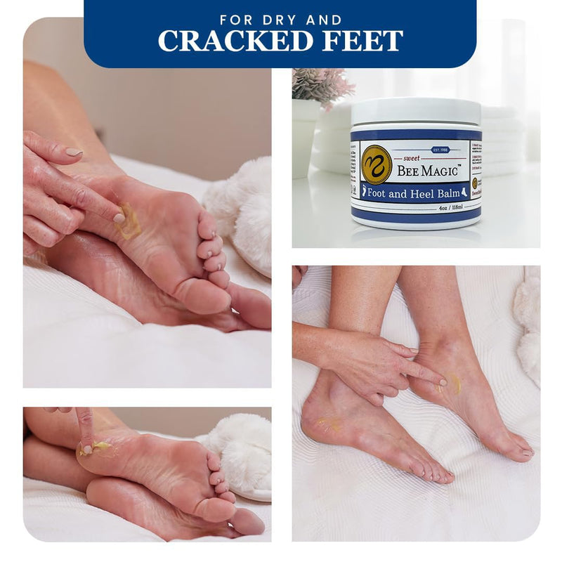 Sweet Bee Naturals Organic Foot Balm - Intensive Heel Balm for Dry Cracked Feet - Natural Moisturizing Treatment for Cracked Heels - Heel Cream Softener for Rough Skin Repair – 4 OZ Jar 4 Ounce (Pack of 1)