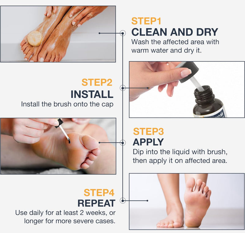[Australia] - Bee Venom Skin Wart Remover: Fast-Acting 20% salicylic Acid Skin Wart Remover for Plantar Wart, Genital Wart 