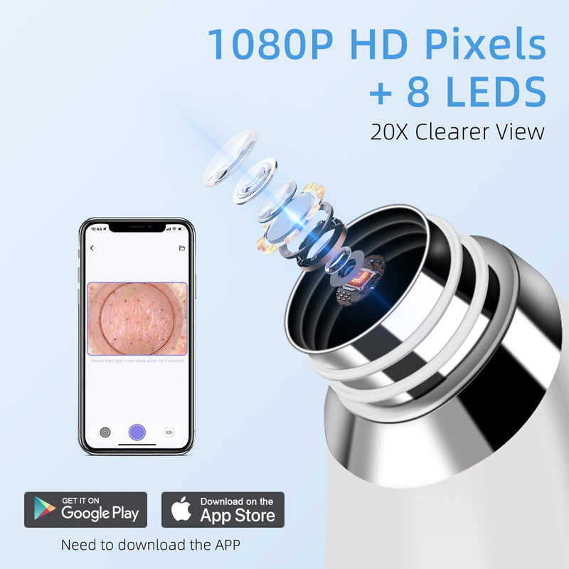 Blackhead Remover Vacuum, Pore Vacuum with 1080p HD Camera, Visible Facial Pore Cleanser with 4 Suction Heads, 5 Speeds, Black Head Remover Tool Pimple Acne Whitehead Extractor Kit (White) White