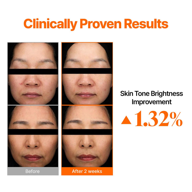 COSNORI Origin Vitamin C 25% Tone-Up Ampoule | High-Potency Vitamin C Serum for Dark Spots & Even Skin Tone, Intensive Night Serum for Firm & Smooth-Looking Skin, Low Irritation, Korean Skin Care Unscented COSNORI Origin Vitamin C 25% Tone-Up Ampoule