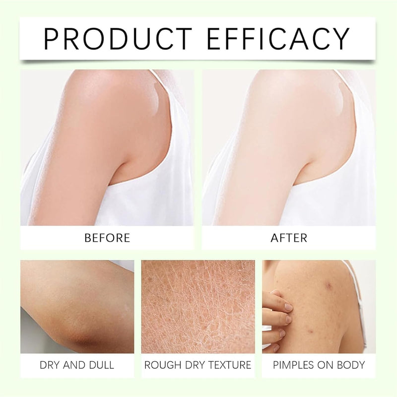 Mama-Bear Neuropathy Cream, Magnesium Body Butter,Magnesium Cream for Neuropathy, Deeply Moisturizes Skin, Keep Soft Smooth, Suitable for All Skin Types (114g/1pcs) white1pc