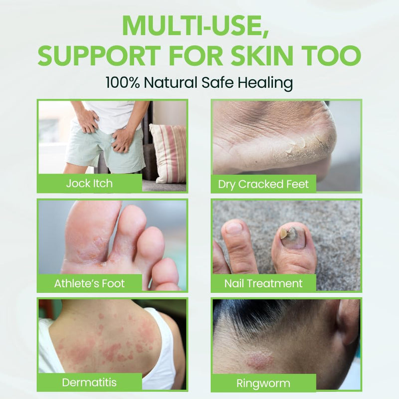 Thena Athletes Foot Cream Extra Strength Herbal Relief with Tea Tree Neem & Menthol, Athletes Foot Treatment Balm for Itchy Dry Cracked Feet, Heels and Toes, Advanced Plant-Based Foot Care Power6 Blend 2 Ounce (Pack of 1)