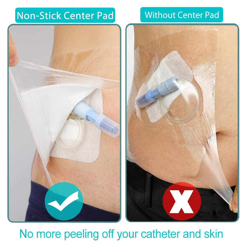 [Australia] - Waterproof Dialysis Catheter Shower Cover 8x8 - No Glue On The Center of The Patch, PD Peritoneal Dialysis Port Shower Protector Shield Island Bandage Dressing Patch Accessories (Pack of 25) (8"x8"+pad)-25pcs 