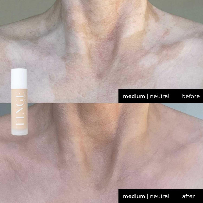 [Australia] - Tinge Tint Body Makeup, Lasts Up to 48 Hours, Medium Coverage With Amino Acids, Hyaluronic Acid & Lysine, Semi Matte Finish, Water & Transfer Resistant, 3.38 Fl Oz - Medium Neutral 
