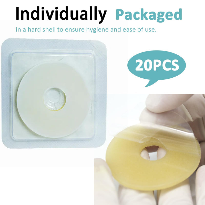 [Australia] - 20PCS Ostomy Barrier Rings, Medical Hydrocolloid Ostomy Supplies, Moldable Ostomy Ring, Leak-Free Skin Extender Rings, Stoma Protector Seal for Colostomy Bags 