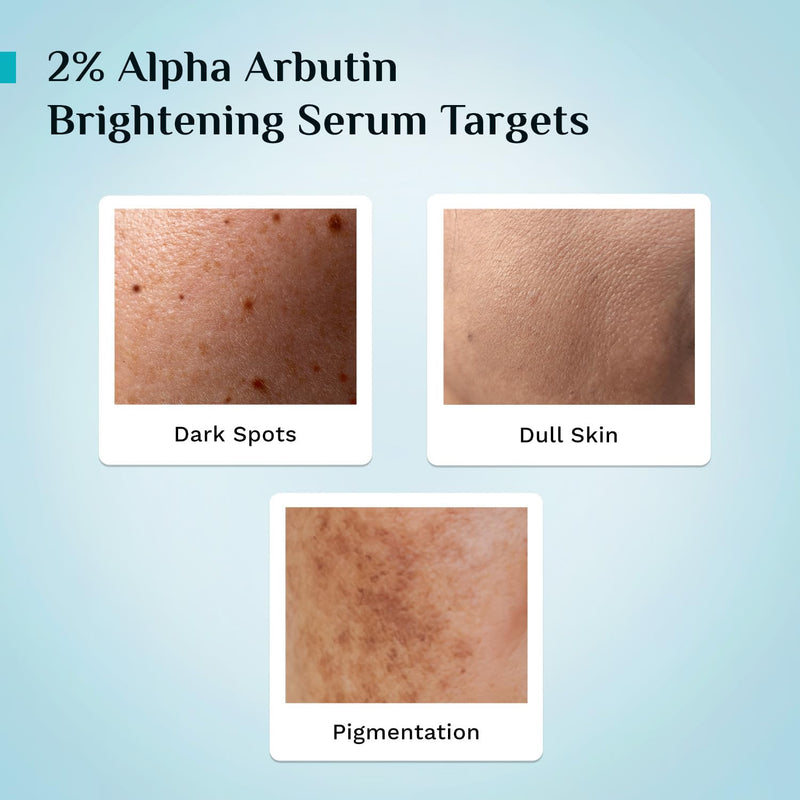 Pilgrim 2% Alpha Arbutin & 3% Vitamin C Face Serum | with Korean White Lotus & Blueberry | All Skin Types | Vegan & Cruelty-Free | 1 Fl Oz (30 mL)