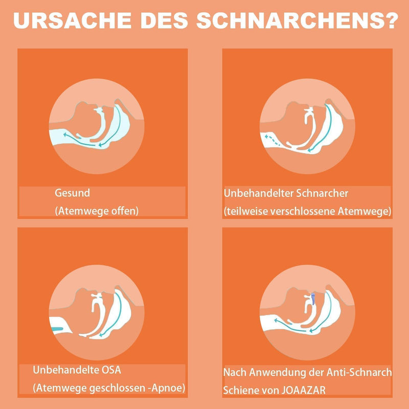 [Australia] - Snoring splint, anti-snoring splint, snoring stopper, snoring-free pro, snoring splint for men and women, anti-snoring mouthpiece 