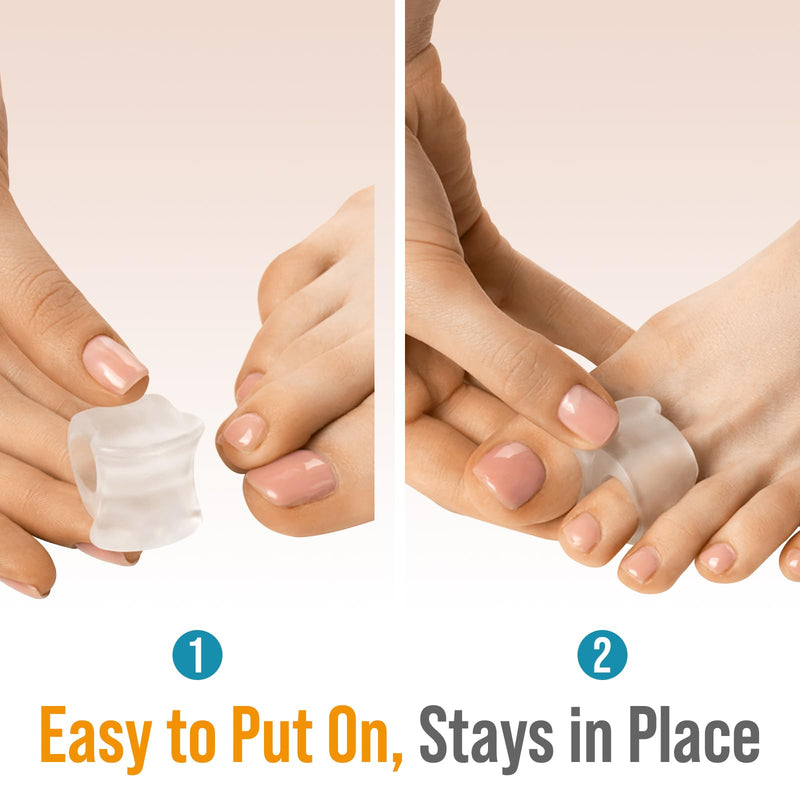 [Australia] - 5 STARS UNITED Toe Spacers for Men and Women – 4 Gel Toe Separators for Curled and Overlapping Toes, Bunions, Hammer Toe Straightener, Big and Second Toe Spreader - Clear Big 4 Pack Clear 