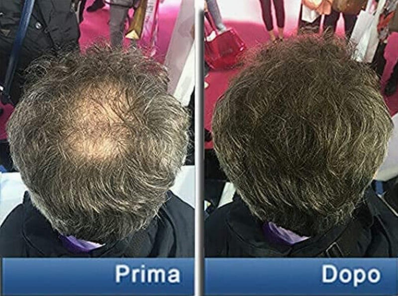 Pantogar Specific Treatment for Hair and Nails 90 caps
