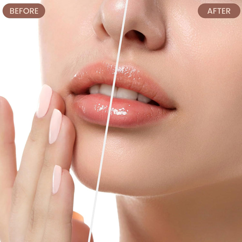 [Australia] - Facial Hair Remover for Women – Electric Face Razor with Light, Hair Removal for Upper Lip, Chin & Cheeks – Color Champagne 