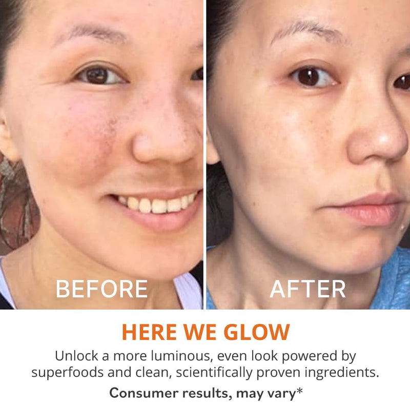 goPure Actives Vitamin C Serum - Brightening Serum with Vitamin C and Ferulic Acid, Face Moisturizing and Anti-Aging Benefits, Improves Skin Discoloration and Visibly Reduces Dark Spots - 1 fl oz