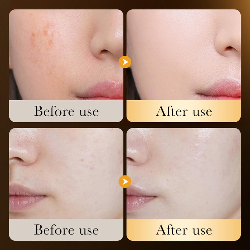Golden Hyaluronic Acid Moisture and Repair Sense