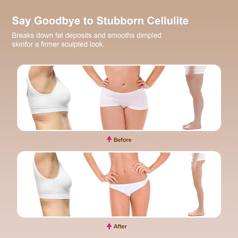 [Australia] - Lymphatic Drainage Massager for Legs, Arms & Belly – Anti Cellulite & Stretch Marks Reduction Tool with Microcurrent, Heat, Vibration & Light Therapy – Portable Body Sculpting Machine for Home Use 