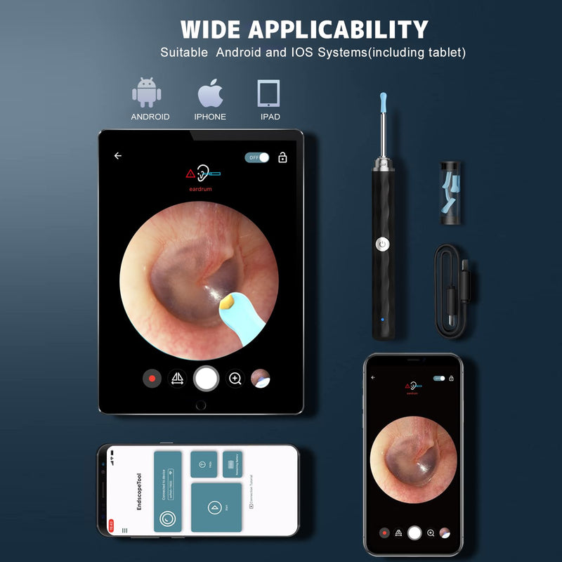 [Australia] - Ear Wax Removal, Ear Cleaner with Camera and Light, Ear Wax Removal Kit with 1296P Otoscope, Ear Cleaning Tool with 6 Ear Spoon, Ear Camera for iPhone & Android Phones,Black Black 
